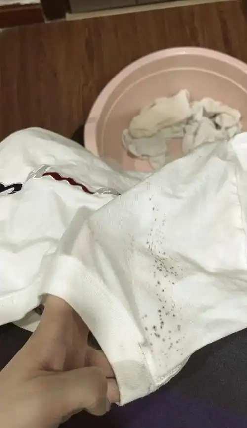 如何清洗环卫工作服上的霉斑？	